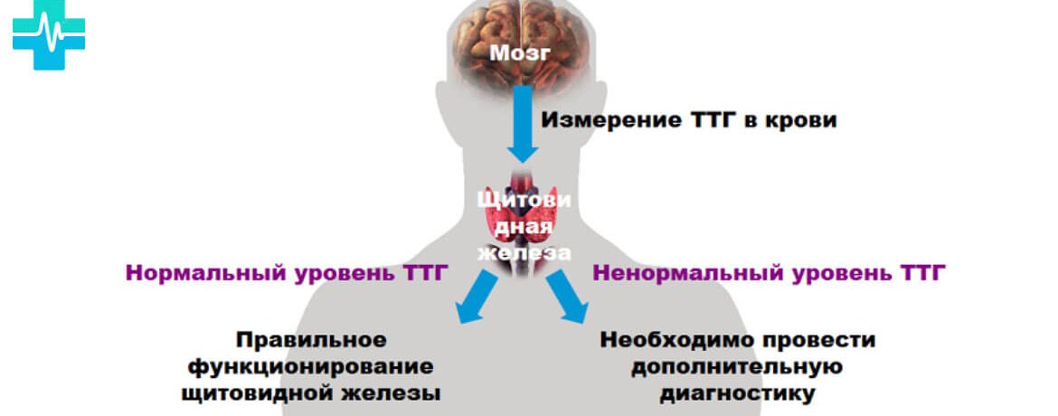 Высокий TSH: причины