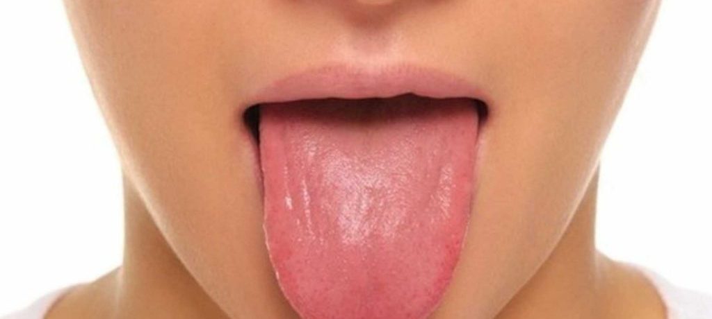 Почему мне кажется, что я собираюсь проглотить свой язык?