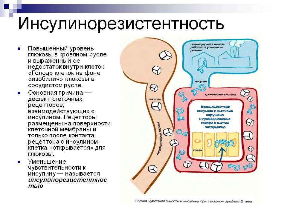 Инсулиновая резистентность: причины, симптомы и лечение