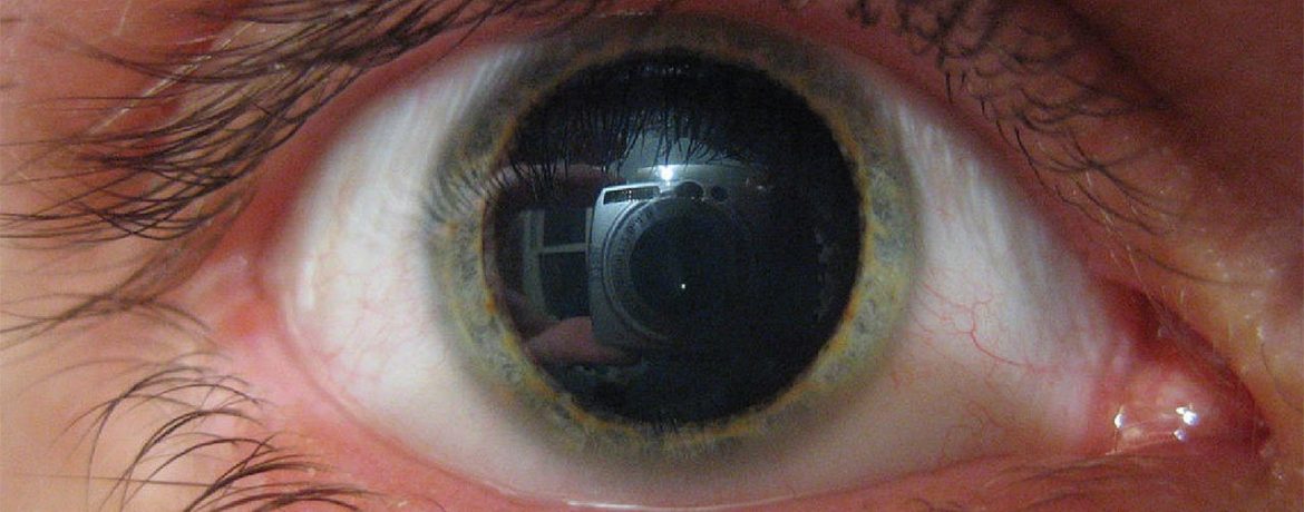 Почему мои зрачки постоянно расширены?