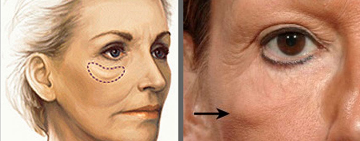 Опухшая увула: причины и лечение