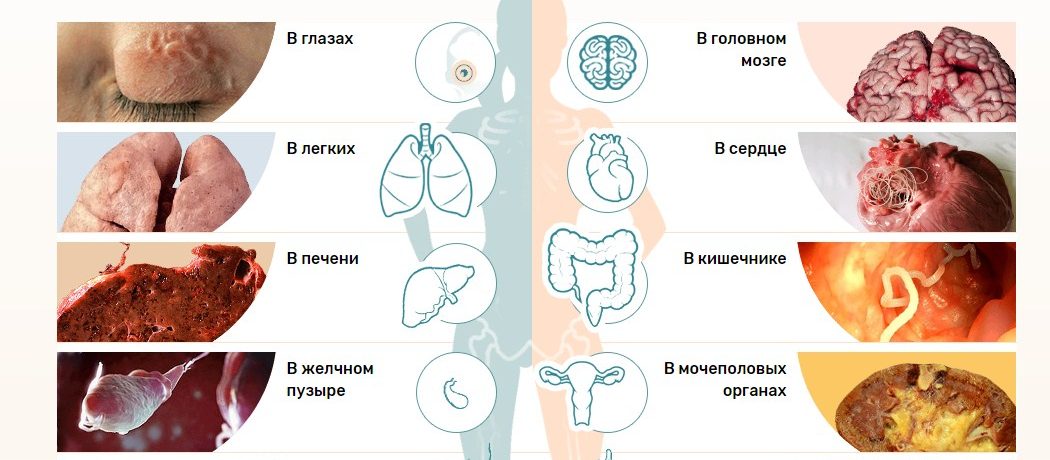 Основные симптомы паразитоза