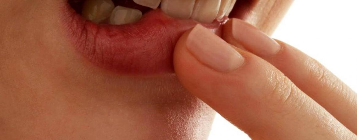 Заживление пролежней во рту