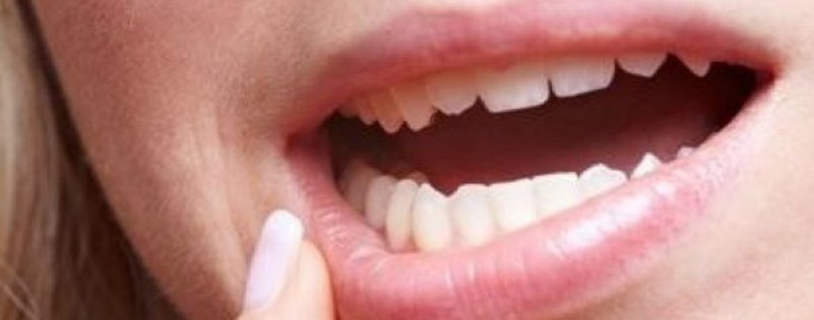 Средства от ран в полости рта